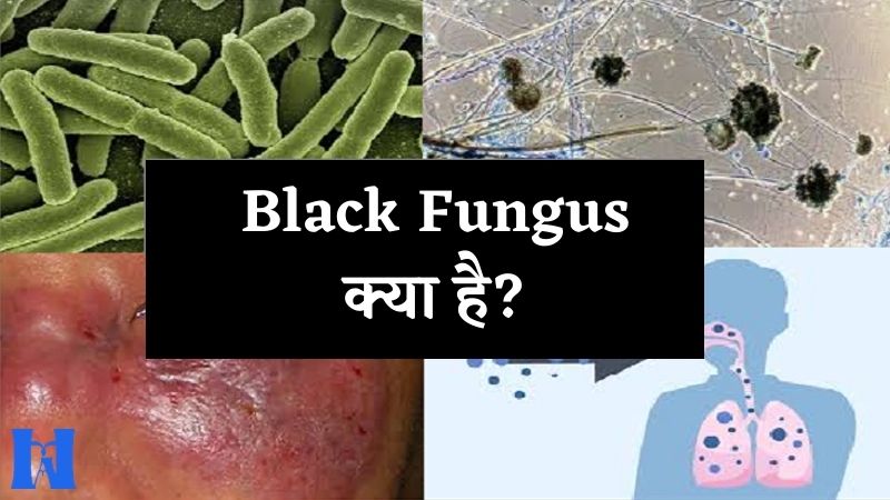 Black Fungus kya hai