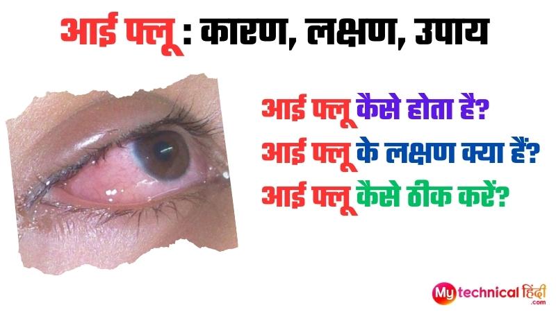 Eye flu kaise hota hai : आई फ्लू कारण, लक्षण, उपाय